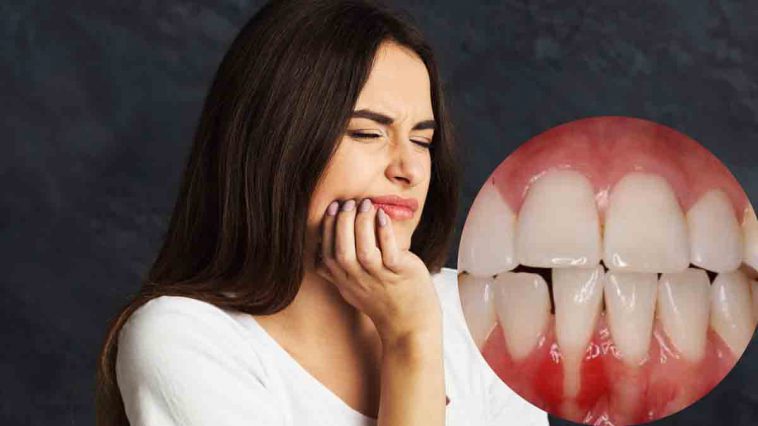 9 astuces contre les maux de dents